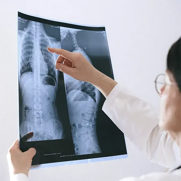 Scoliosis Treatment Near You in Columbia, TN. Chiropractor For Scoliosis Pain Relief.