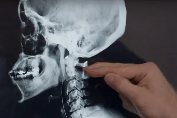 Best Chiropractic Care Near Me in Columbia, TN.